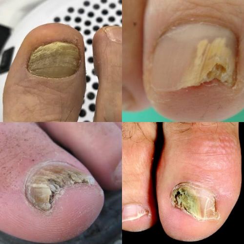 Mobile Foot Care Edmonton